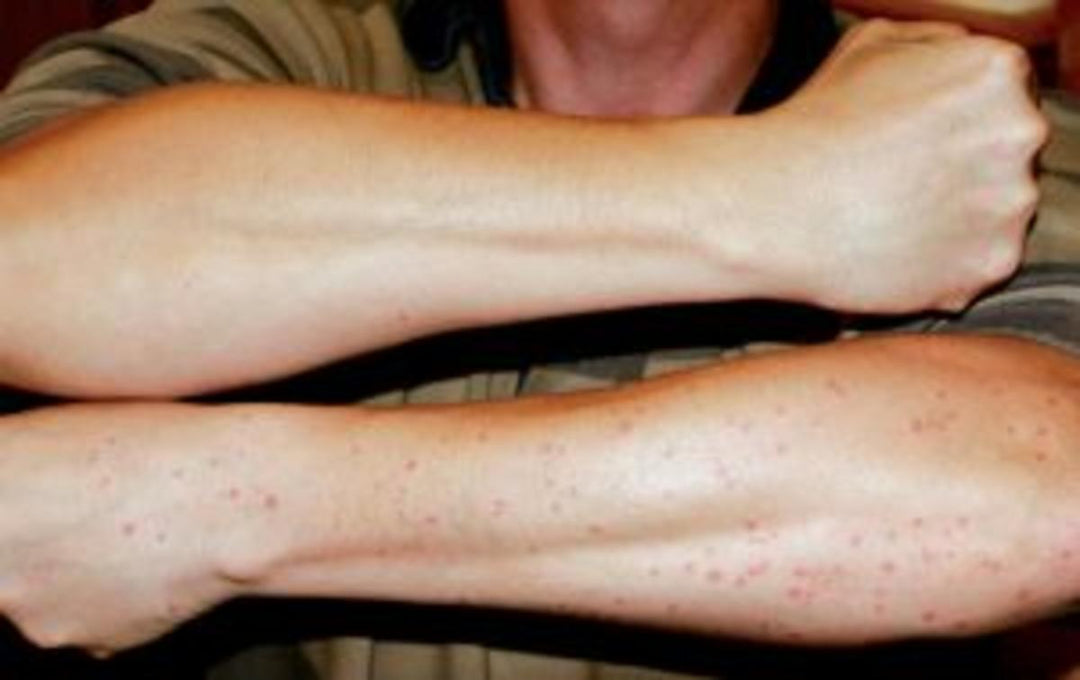 Smidge Smidge Repellent (pump spray) 75ml