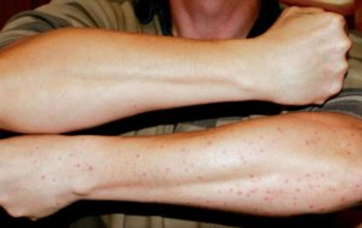 Smidge Smidge Repellent (pump spray) 75ml